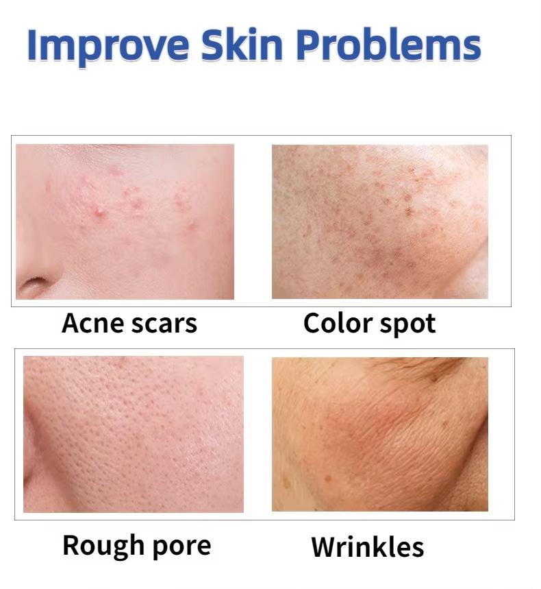 LDM Pen Dual-Frequency Ultrasound Device